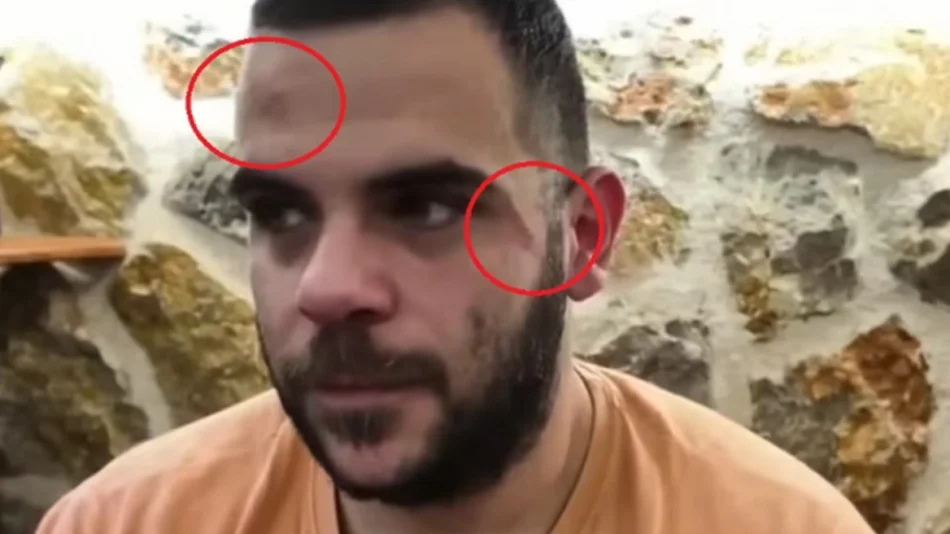 Ξυλοκόπησαν άγρια γνωστό YouTuber σε ζωντανή μετάδοση στα Γιάννενα! (VIDEO)